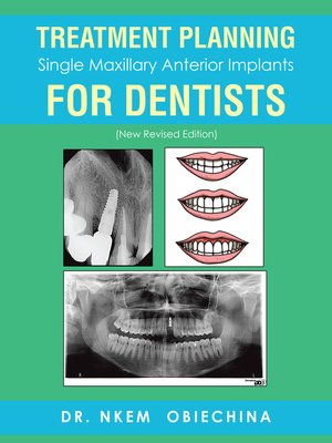 cover image of Treatment Planning Single Maxillary Anterior Implants for Dentists